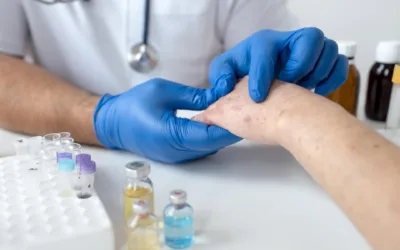 Lupus: What Is It? Symptoms and Treatment